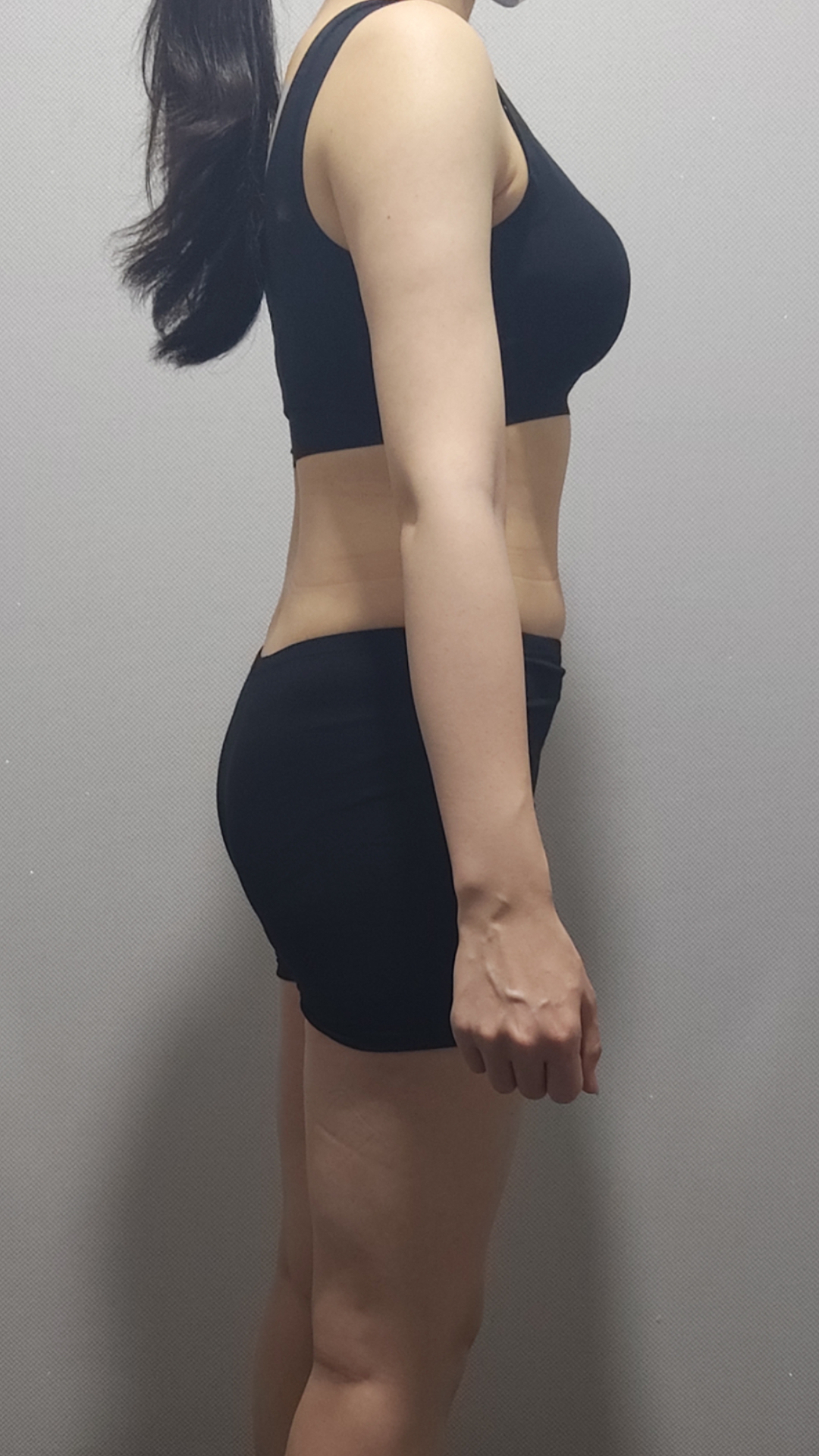 -4.4 사례 복용 전 사진