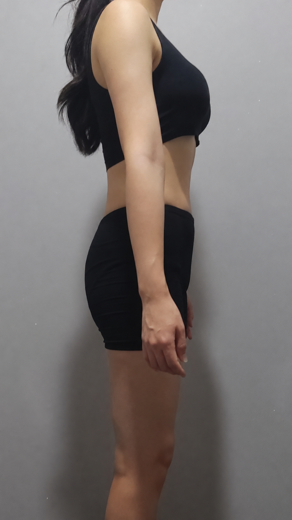 -4.4 사례 복용 후 사진